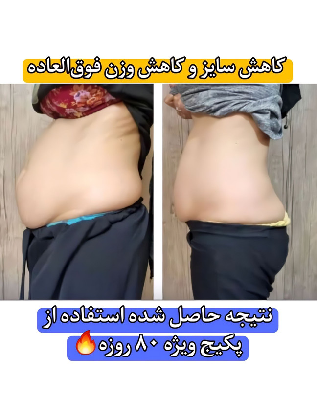 دوره لاغری قرص SP (اسپیرولینا پلاس) کاهش وزن ۲۸ تا ۳۵ کیلوگرم در ۱۲۰ روز