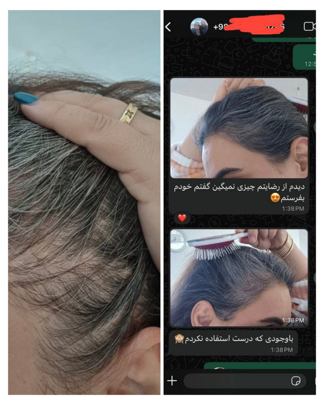 دوره رویش مجدد مو و ریش 🧔🏻♀️