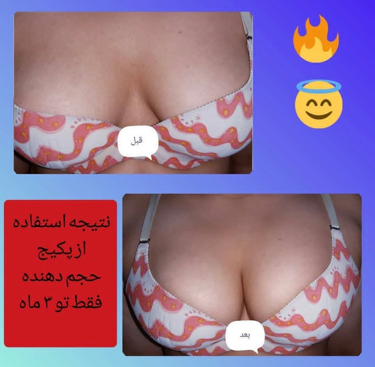 دوره حجم سینه 🍒